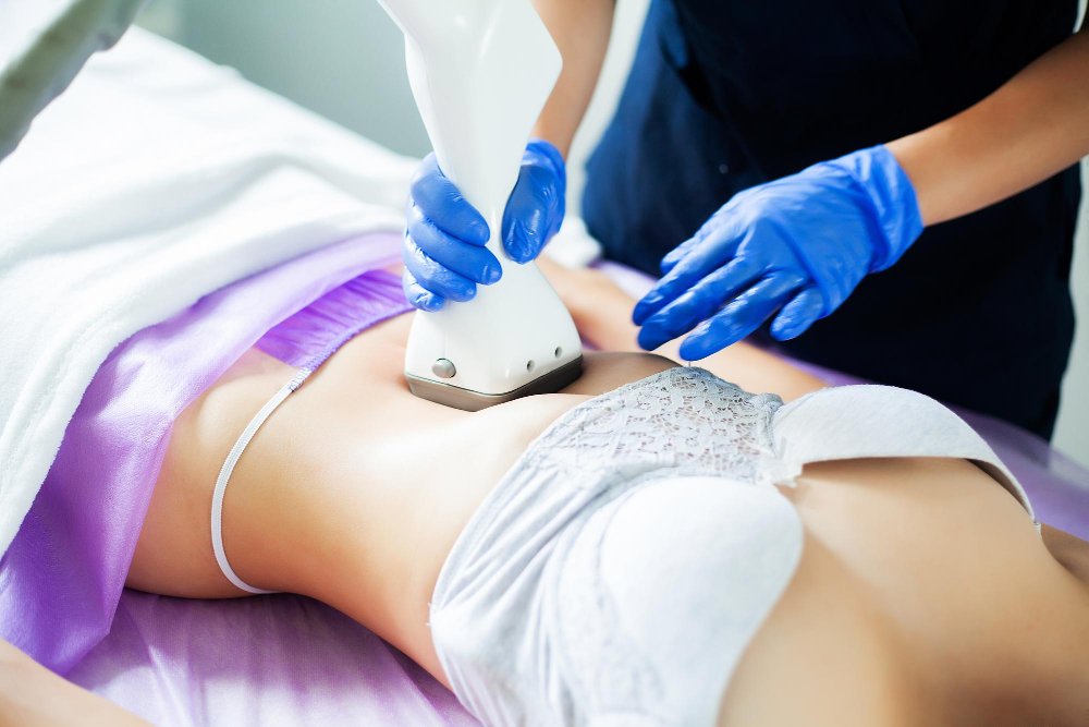 Laser Lipolysis Treatment