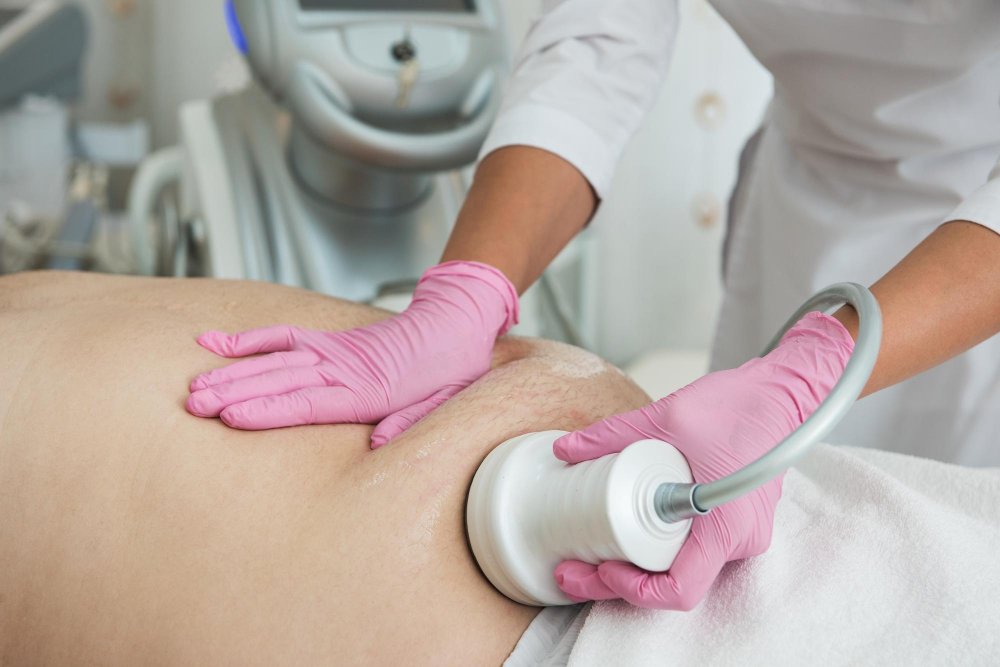 Ultrasound Cavitation Treatment