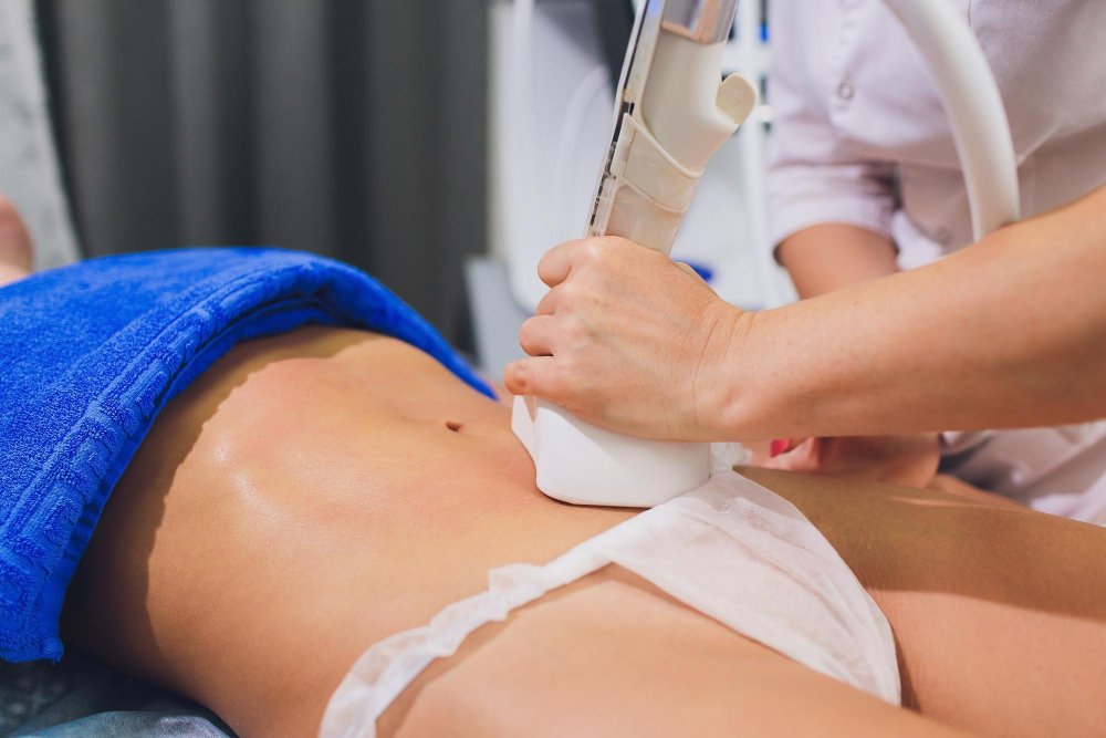 Laser Lipolysis Treatment